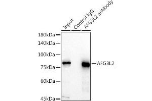 Immunoprecipitation analysis of 300 μg extracts of HeLa cells using 3 μg L2 antibody (ABIN7265513). (AFG3L2 antibody  (AA 538-797))