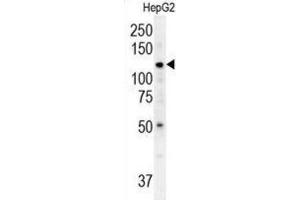 Western Blotting (WB) image for anti-ATPase Type 13A3 (ATP13A3) antibody (ABIN3002493)
