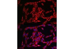 Immunofluorescence (IF) image for anti-Fibroblast Growth Factor Receptor 3 (FGFR3) (AA 39-138) antibody (ABIN1679839)