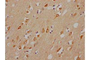 IHC image of ABIN7127632 diluted at 1:100 and staining in paraffin-embedded human brain tissue performed on a Leica BondTM system. (Recombinant CHRM3 antibody)