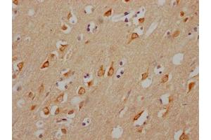 IHC image of ABIN7127632 diluted at 1:100 and staining in paraffin-embedded human brain tissue performed on a Leica BondTM system. (Recombinant CHRM3 antibody)