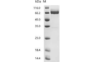 (Tris-Glycine gel) Discontinuous SDS-PAGE (reduced) with 5 % enrichment gel and 15 % separation gel.