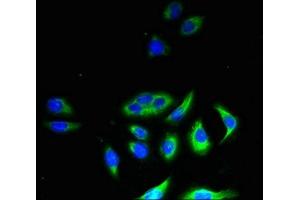 Immunofluorescent analysis of A549 cells using ABIN7158866 at dilution of 1:100 and Alexa Fluor 488-congugated AffiniPure Goat Anti-Rabbit IgG(H+L) (M-CSF/CSF1 antibody  (AA 33-554))