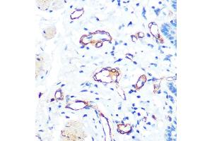Immunohistochemistry of paraffin-embedded human esophageal using von Willebrand factor (VWF) Rabbit mAb (ABIN6129836, ABIN6144889, ABIN6144890 and ABIN7101425) at dilution of 1:100 (40x lens). (VWF antibody)