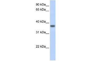 TMEM173 antibody used at 1 ug/ml to detect target protein.
