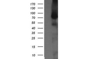 Image no. 1 for anti-NIMA (Never In Mitosis Gene A)-Related Kinase 11 (NEK11) antibody (ABIN1499682) (NEK11 antibody)