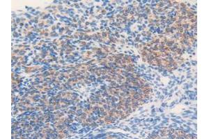 IHC-P analysis of Mouse Ovary Tissue, with DAB staining. (MGST1 antibody  (AA 8-155))