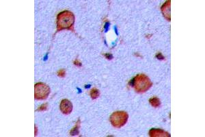 Immunohistochemical analysis of GLP-1 Receptor staining in human brain formalin fixed paraffin embedded tissue section. (GLP1R antibody  (Center))