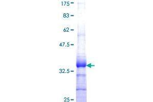 SLURP1 Protein (AA 25-102) (GST tag)