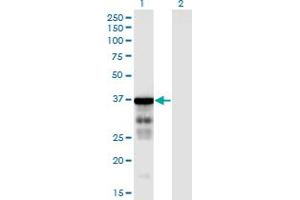Western Blot analysis of CLUAP1 expression in transfected 293T cell line by CLUAP1 monoclonal antibody (M05), clone 6E12. (CLUAP1 antibody  (AA 1-247))