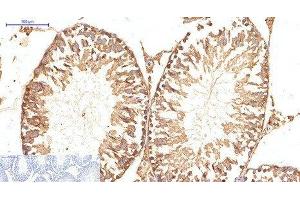 Immunohistochemistry of paraffin-embedded Rat testis tissue using ATG5 Monoclonal Antibody at dilution of 1:200. (ATG5 antibody)