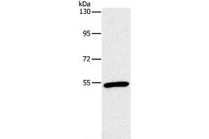 Western Blot analysis of Mouse heart tissue using OXTR Polyclonal Antibody at dilution of 1:866 (Oxytocin Receptor antibody)