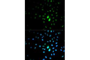 Immunofluorescence analysis of MCF-7 cells using PIN1 antibody. (PIN1 antibody)