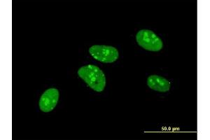 Immunofluorescence of monoclonal antibody to PKNOX1 on HeLa cell. (PKNOX1 antibody  (AA 2-100))