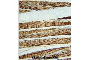 Immunohistochemistry (Paraffin-embedded Sections) (IHC (p)) image for anti-Actin, beta (ACTB) antibody (ABIN658990)