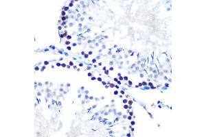 Immunohistochemistry of paraffin-embedded rat testis using mSin3A Rabbit mAb (ABIN7270318) at dilution of 1:100 (40x lens). (SIN3A antibody)
