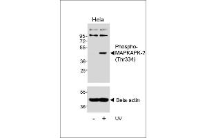 Western blot analysis of lysates from Hela cell line, untreated or treated with UV, 30 min, using 456580101 (ABIN6241065 and ABIN6578952) (upper) or Beta-actin (lower). (MAPKAP Kinase 2 antibody  (pThr334))