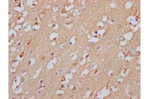 IHC image of ABIN7127506 diluted at 1:100 and staining in paraffin-embedded human brain tissue performed on a Leica BondTM system. (Recombinant GABRA5 antibody)