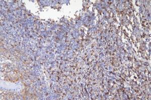 IHC analysis of CD5 using anti-CD5 antibody (ABIN7600913). (CD5 antibody  (AA 25-495))