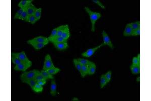 Immunofluorescence (IF) image for anti-Sodium Channel, Nonvoltage-Gated 1, beta (SCNN1B) (AA 554-640) antibody (ABIN7143973)