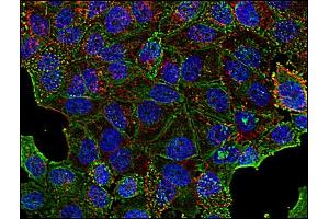 Immunocytochemistry staining of clathrin in human HeLa cell line using anti-clathrin (BF-06, green). (Clathrin Heavy Chain (CLTC) antibody)