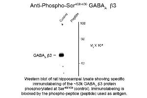 Western Blot of Anti-GABA(A) Receptor beta 3 pS408/pS409 (Rabbit) Antibody - 612-401-D51 Western Blot of Rabbit anti-GABA(A) Receptor beta 3 pS408/pS409 antibody. (GABRB3 antibody  (pSer408, pSer409))