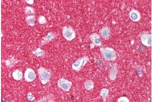 Human Brain, Cortex (formalin-fixed, paraffin-embedded) stained with NCAM1 antibody ABIN239829 at 10 ug/ml followed by biotinylated anti-mouse IgG secondary antibody ABIN481714, alkaline phosphatase-streptavidin and chromogen. (CD56 antibody)