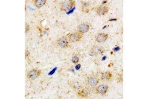 Immunohistochemical analysis of PACAP-R1 staining in human brain formalin fixed paraffin embedded tissue section. (ADCYAP1R1 antibody)