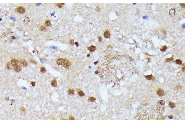 VIRMA/KIAA1429 antibody