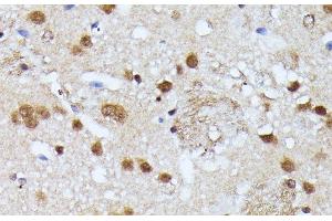 Immunohistochemistry of paraffin-embedded Mouse brain using KIAA1429 Polyclonal Antibody at dilution of 1:100 (40x lens).