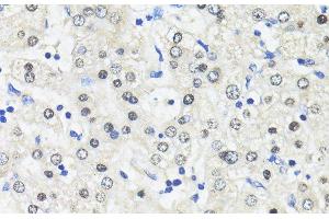 Immunohistochemistry of paraffin-embedded Human liver using TRIM27 Polyclonal Antibody at dilution of 1:100 (40x lens). (TRIM27 antibody)