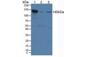 Western blot analysis of (1) Mouse Serum, (2) Mouse Placenta Tissue and (3) Human HeLa cells.