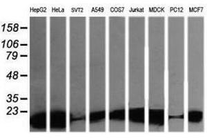 Image no. 9 for anti-Leucine Zipper and CTNNBIP1 Domain Containing (LZIC) antibody (ABIN1499239) (LZIC antibody)