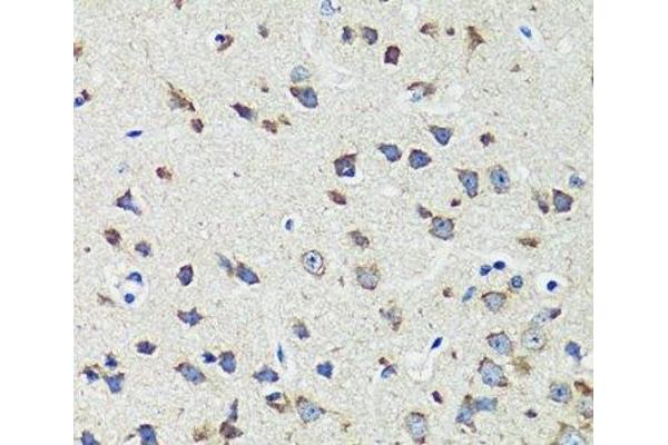 CCDC124 antibody