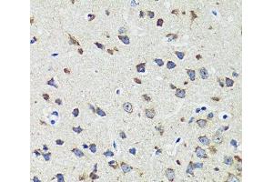 Immunohistochemistry of paraffin-embedded Mouse brain using CCDC124 Polyclonal Antibody at dilution of 1:100 (40x lens). (CCDC124 antibody)