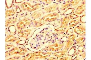 IHC image of ABIN7156316 diluted at 1:300 and staining in paraffin-embedded human kidney tissue performed on a Leica BondTM system. (OCRL antibody  (AA 121-271))