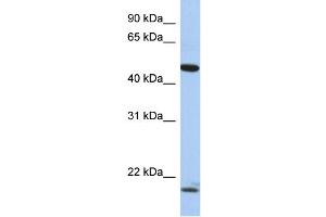 WB Suggested Anti-PLAGL1 Antibody Titration:  0. (PLAGL1 antibody  (N-Term))