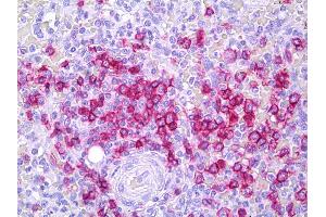 Anti-CD45RB antibody IHC of human spleen, lymphocytes. (CD45RB antibody  (FITC))