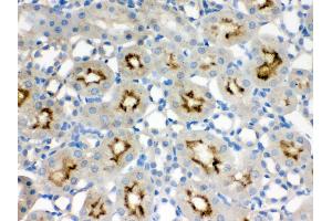 Anti- SMC3 Picoband antibody, IHC(P) IHC(P): Rat Kidney Tissue (SMC3 antibody  (C-Term))