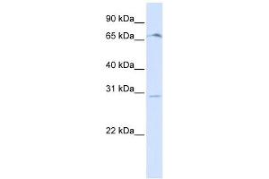 OR6C75 antibody used at 1 ug/ml to detect target protein. (OR6C75 antibody  (Middle Region))
