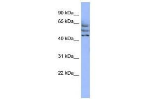 C3ORF19 antibody used at 1 ug/ml to detect target protein. (CCDC174 antibody  (Middle Region))