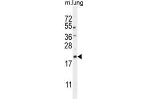 Western Blotting (WB) image for anti-APG8a,b antibody (ABIN2995751) (APG8a,b antibody)