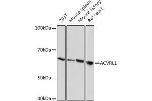 Western blot analysis of extracts of various cell lines, using  Rabbit mAb (ABIN7265412) at 1:1000 dilution. (ACVRL1 antibody)
