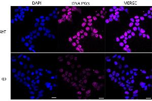 Immunocytochemical staining of Hela cells using DNA PKcs antibody (ABIN7800013), 1:1,000), Top panel: wild-type (WT), Bottom panal: DNA PKcs shRNA knockdown (KD). (Recombinant PRKDC antibody)