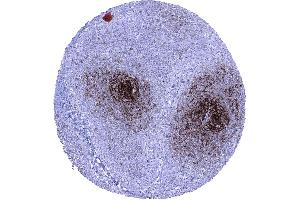 Lymph node In lymph nodes a strong CD23 immunostaining is seen in follicular dendritic cells of germinal centres while staining is moderate in follicular and perifollicular B lymphocytes (FCER2 antibody  (AA 48-321))