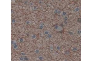 Used in DAB staining on fromalin fixed paraffin- embedded Kidney tissue (SCAND3 antibody  (AA 366-526))