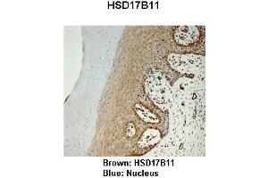 Sample Type :  Monkey vagina   Primary Antibody Dilution :   1:25   Secondary Antibody:  Anti-rabbit-HRP   Secondary Antibody Dilution:   1:1000   Color/Signal Descriptions:  Brown: HSD17B11 Blue: Nucleus   Gene Name:  HSD17B11   Submitted by:  Jonathan Bertin, Endoceutics Inc. (HSD17B11 antibody  (N-Term))