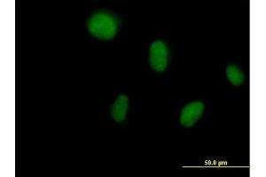 Immunofluorescence of purified MaxPab antibody to DCK on HeLa cell. (DCK antibody  (AA 1-260))