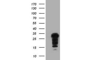 Image no. 1 for anti-Synovial Sarcoma, X Breakpoint 5 (SSX5) antibody (ABIN1501163) (SSX5 antibody)