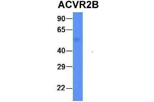 Host:  Rabbit  Target Name:  FAM46C  Sample Type:  Human Fetal Liver  Antibody Dilution:  1. (ACVR2B antibody  (Middle Region))